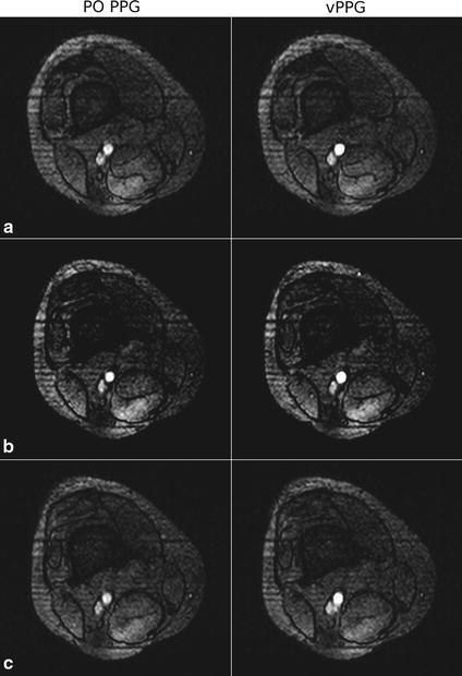 https://cdn.ncbi.nlm.nih.gov/pmc/blobs/99e0/5122166/ebada6f55b29/12938_2016_245_Fig13_HTML.jpg