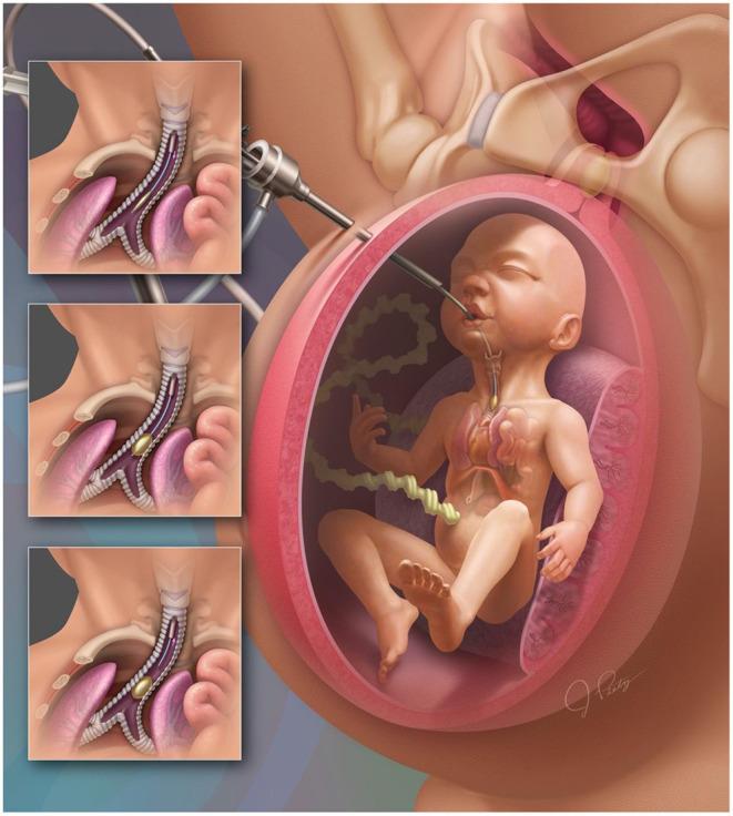 https://cdn.ncbi.nlm.nih.gov/pmc/blobs/99e0/9294219/4253282a2a5b/fped-10-925106-g0001.jpg
