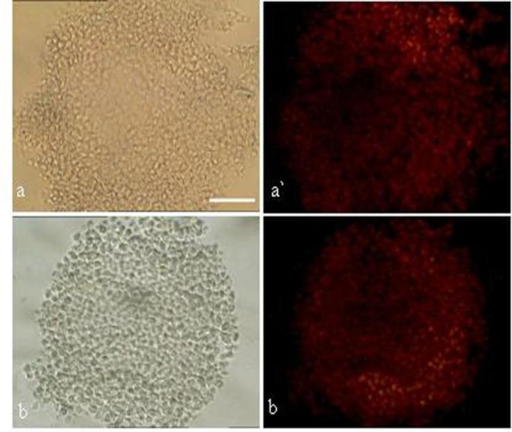 https://cdn.ncbi.nlm.nih.gov/pmc/blobs/99e1/4165970/091a90393487/ijrm-10-257-g002.jpg