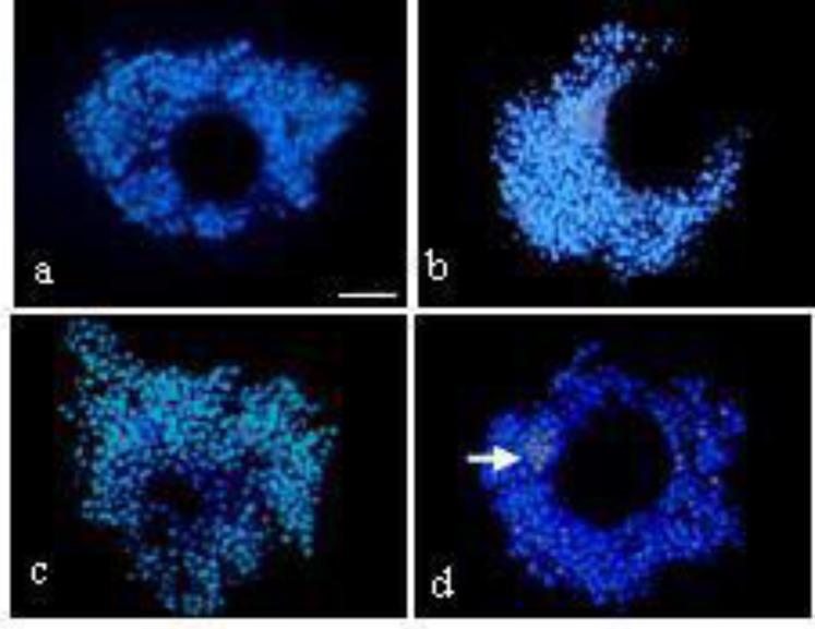https://cdn.ncbi.nlm.nih.gov/pmc/blobs/99e1/4165970/dc6449610fb3/ijrm-10-257-g001.jpg