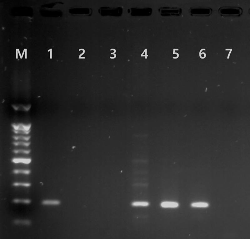 https://cdn.ncbi.nlm.nih.gov/pmc/blobs/99e2/7164670/ab200139859a/pntd.0008229.g001.jpg