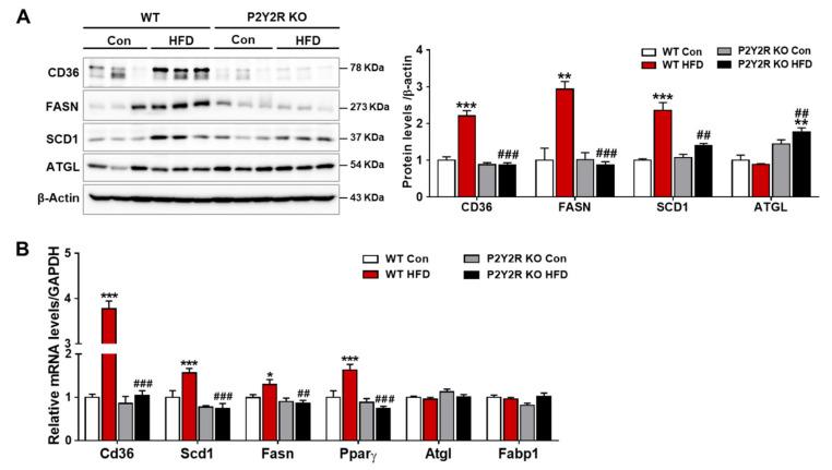 https://cdn.ncbi.nlm.nih.gov/pmc/blobs/99ed/8197197/14ef06d6fa57/ijms-22-05528-g003.jpg