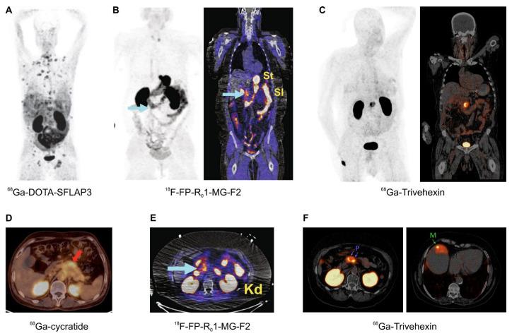https://cdn.ncbi.nlm.nih.gov/pmc/blobs/99ef/8657165/d333ee043040/cancers-13-05958-g006.jpg