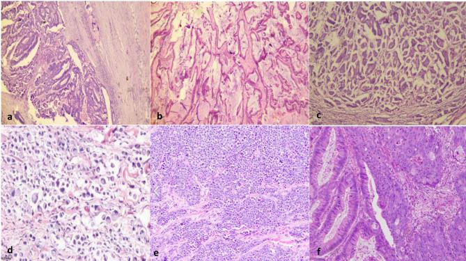 https://cdn.ncbi.nlm.nih.gov/pmc/blobs/99f1/12010690/639973f05073/12876_2025_3862_Fig1_HTML.jpg