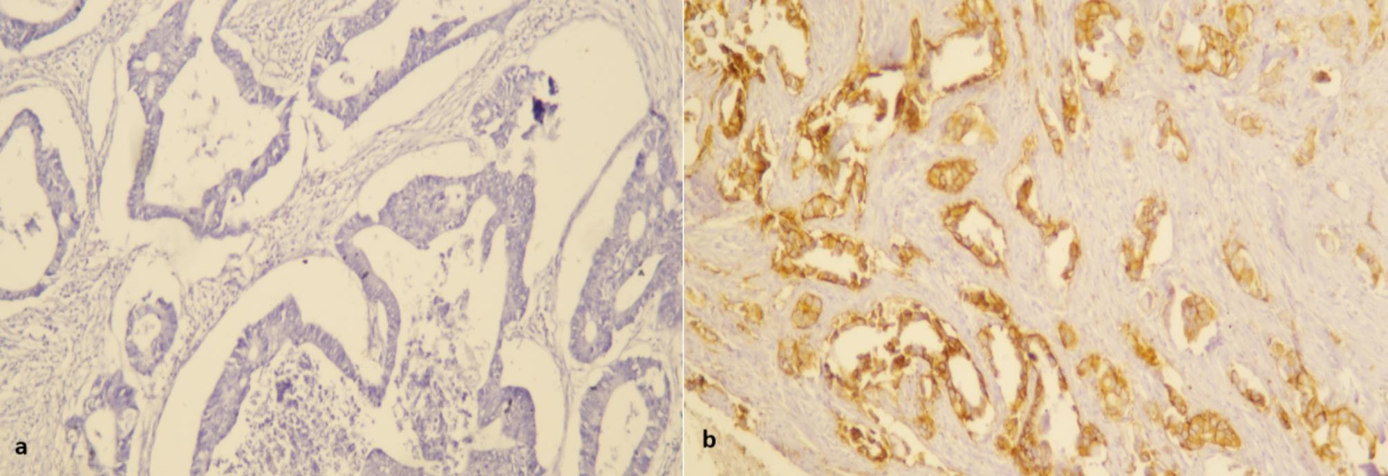 https://cdn.ncbi.nlm.nih.gov/pmc/blobs/99f1/12010690/830814b85665/12876_2025_3862_Fig3_HTML.jpg