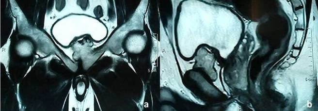 https://cdn.ncbi.nlm.nih.gov/pmc/blobs/99f2/6560973/d35ee2c5b7df/PAMJ-32-74-g002.jpg