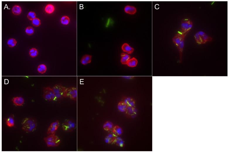 https://cdn.ncbi.nlm.nih.gov/pmc/blobs/99f7/10886653/613e4059bf6c/biomedicines-12-00442-g005.jpg