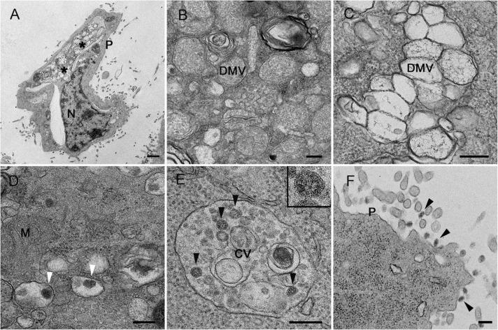 https://cdn.ncbi.nlm.nih.gov/pmc/blobs/99fa/10247892/63c167cc9564/gr4_lrg.jpg