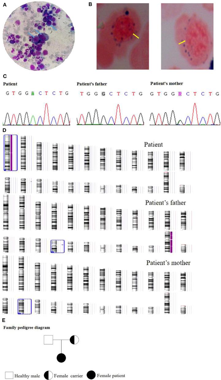 https://cdn.ncbi.nlm.nih.gov/pmc/blobs/99fd/8017196/fc61e27c830d/fped-09-630329-g0001.jpg