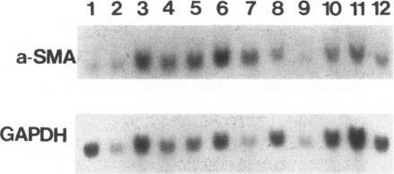 https://cdn.ncbi.nlm.nih.gov/pmc/blobs/9a07/1870756/9be967c2d874/amjpathol00049-0134-a.jpg
