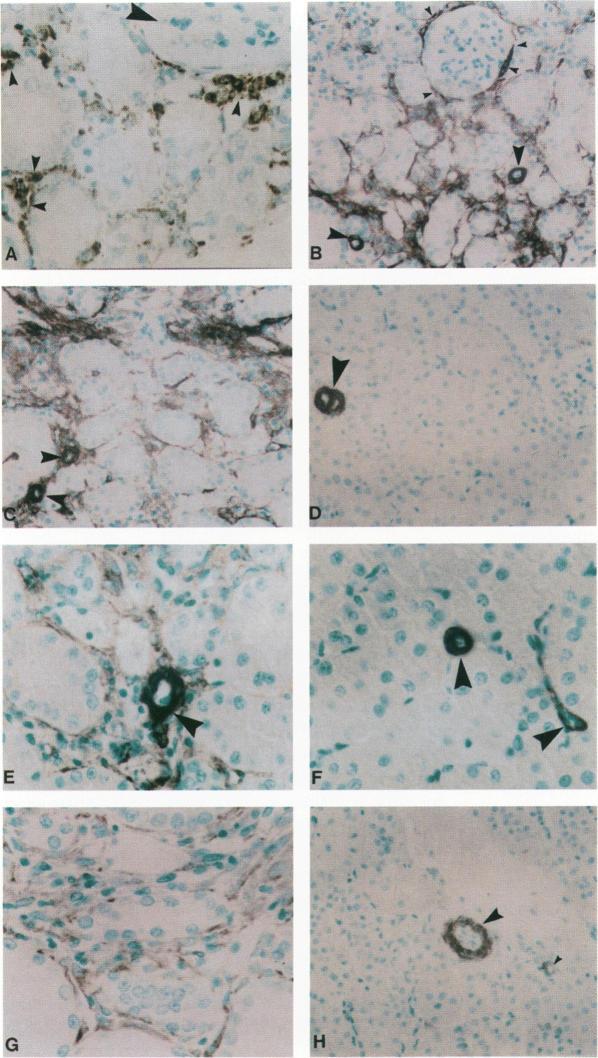 https://cdn.ncbi.nlm.nih.gov/pmc/blobs/9a07/1870756/b68f14ac5988/amjpathol00049-0132-a.jpg