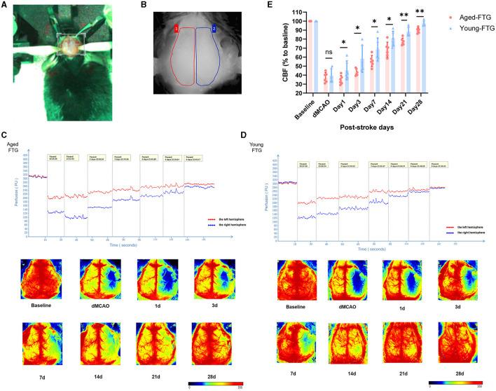 https://cdn.ncbi.nlm.nih.gov/pmc/blobs/9a0f/11450648/40665fbdeaad/fnins-18-1398913-g0009.jpg