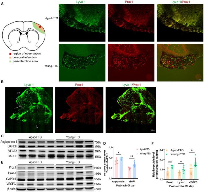 https://cdn.ncbi.nlm.nih.gov/pmc/blobs/9a0f/11450648/f46aa78bda84/fnins-18-1398913-g0012.jpg