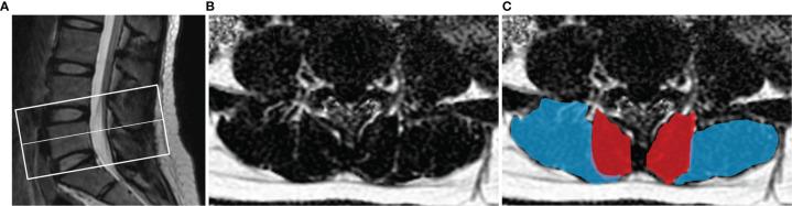 https://cdn.ncbi.nlm.nih.gov/pmc/blobs/9a0f/9204273/62ec94f6425c/fendo-13-792819-g001.jpg