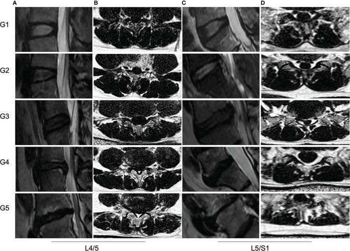 https://cdn.ncbi.nlm.nih.gov/pmc/blobs/9a0f/9204273/8924df843feb/fendo-13-792819-g004.jpg