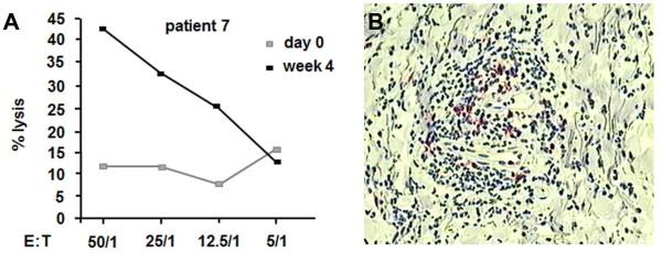 https://cdn.ncbi.nlm.nih.gov/pmc/blobs/9a14/4113220/d9aff5046b83/1479-5876-12-119-4.jpg