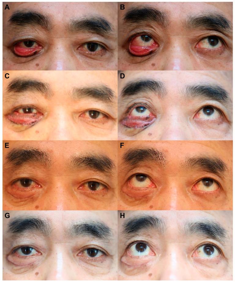 https://cdn.ncbi.nlm.nih.gov/pmc/blobs/9a1f/10971263/281d37ab21b9/life-14-00314-g003.jpg