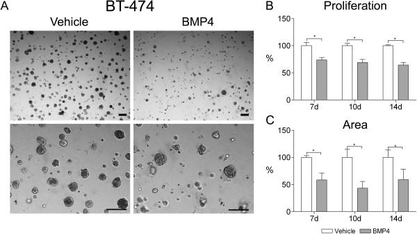 https://cdn.ncbi.nlm.nih.gov/pmc/blobs/9a25/3848934/27f4eed92b44/1471-2407-13-429-4.jpg