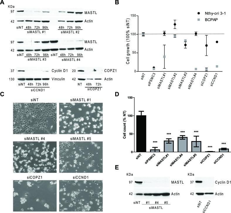 https://cdn.ncbi.nlm.nih.gov/pmc/blobs/9a25/4741478/44133ad80054/oncotarget-06-34629-g005.jpg