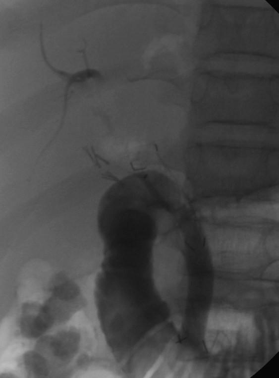 https://cdn.ncbi.nlm.nih.gov/pmc/blobs/9a26/2964605/7da7e7c381d8/1471-230X-10-117-2.jpg