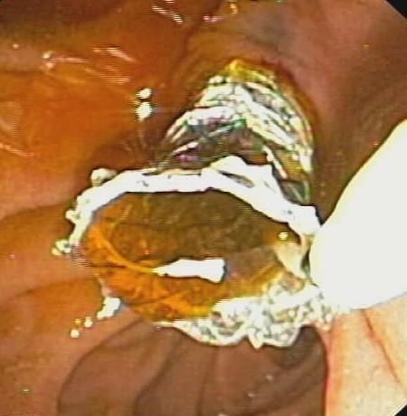https://cdn.ncbi.nlm.nih.gov/pmc/blobs/9a26/2964605/966e19e341f8/1471-230X-10-117-3.jpg