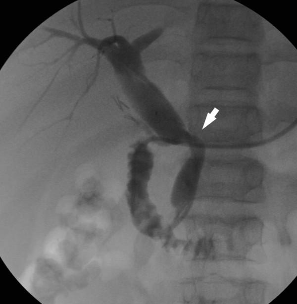 https://cdn.ncbi.nlm.nih.gov/pmc/blobs/9a26/2964605/df7f771baa6b/1471-230X-10-117-1.jpg