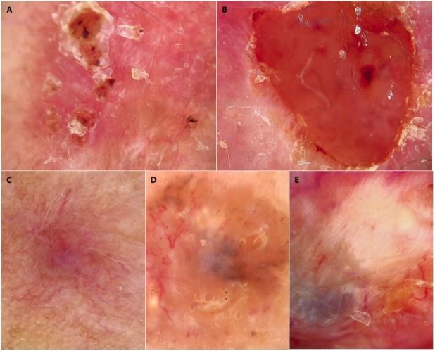 https://cdn.ncbi.nlm.nih.gov/pmc/blobs/9a27/9946123/cee04de48a91/2197dp1301a4g005.jpg