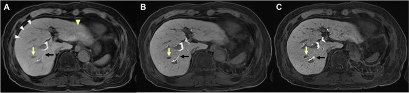 https://cdn.ncbi.nlm.nih.gov/pmc/blobs/9a2a/11399219/c5bed77502f6/330_2024_10693_Fig4_HTML.jpg