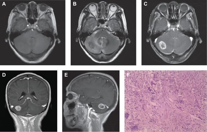 https://cdn.ncbi.nlm.nih.gov/pmc/blobs/9a3b/4277240/64d953183550/ndt-11-021Fig1.jpg