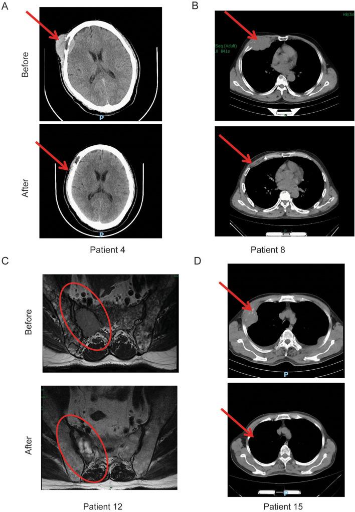 https://cdn.ncbi.nlm.nih.gov/pmc/blobs/9a3c/8722124/61521ce58bac/13046_2021_2214_Fig3_HTML.jpg