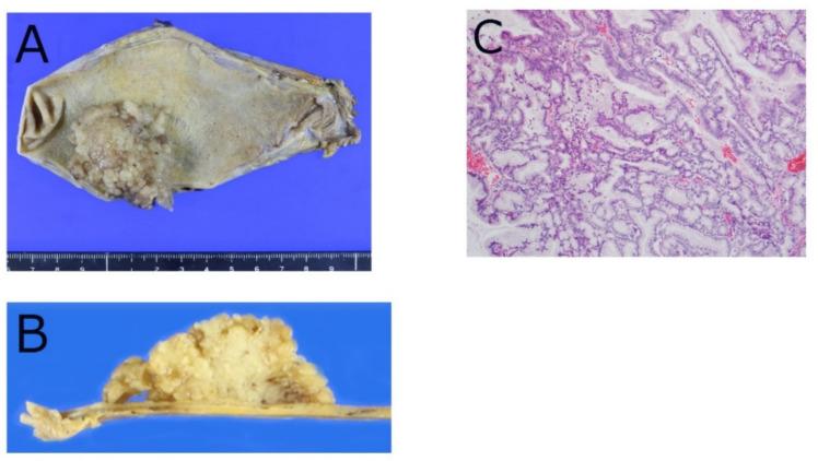 https://cdn.ncbi.nlm.nih.gov/pmc/blobs/9a3c/8871096/98c827f8494d/diagnostics-12-00341-g002.jpg