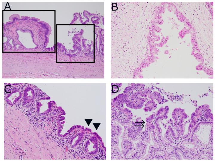 https://cdn.ncbi.nlm.nih.gov/pmc/blobs/9a3c/8871096/9cf49fff4fe5/diagnostics-12-00341-g003.jpg