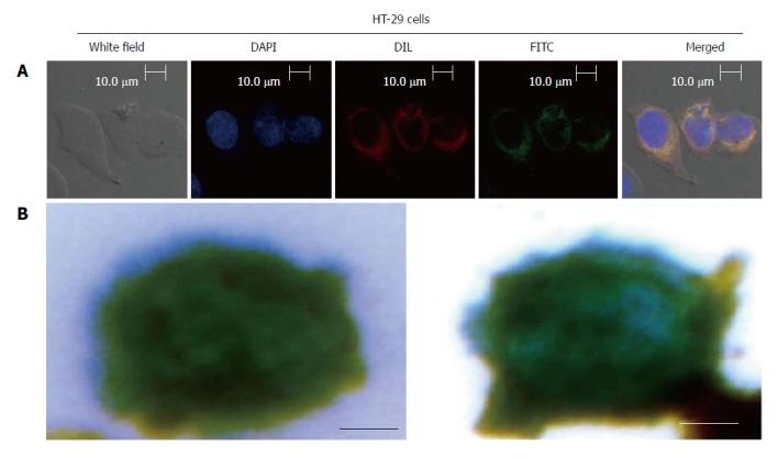 https://cdn.ncbi.nlm.nih.gov/pmc/blobs/9a46/5776396/c25b1558bb60/WJG-24-351-g003.jpg