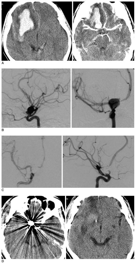 https://cdn.ncbi.nlm.nih.gov/pmc/blobs/9a47/2626701/78025d52112c/kjr-8-2-g001.jpg