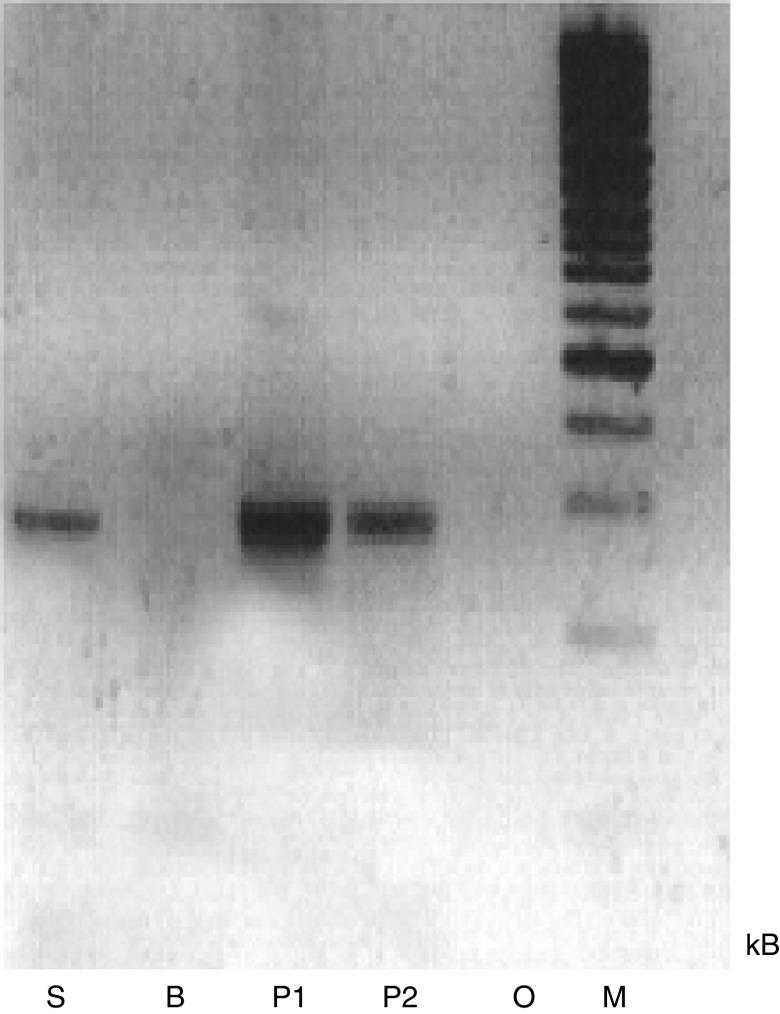https://cdn.ncbi.nlm.nih.gov/pmc/blobs/9a4b/2361670/cf81f872ea64/93-6602835f1.jpg