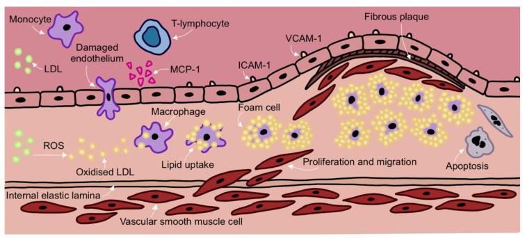https://cdn.ncbi.nlm.nih.gov/pmc/blobs/9a4b/9735601/75f1ff3e5d9b/cells-11-03843-g001.jpg