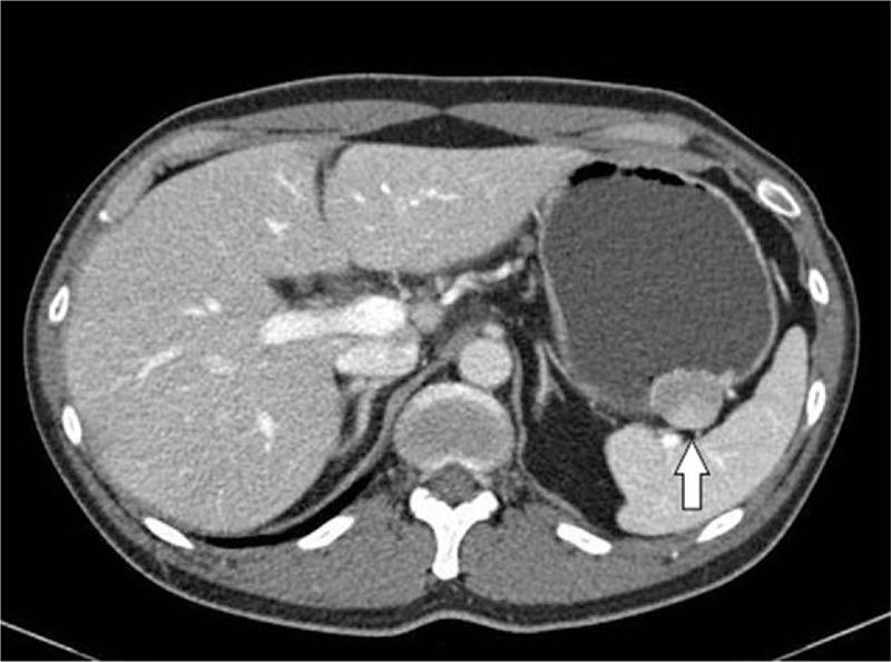 https://cdn.ncbi.nlm.nih.gov/pmc/blobs/9a4c/7478664/88010c6582e6/medi-99-e22078-g003.jpg