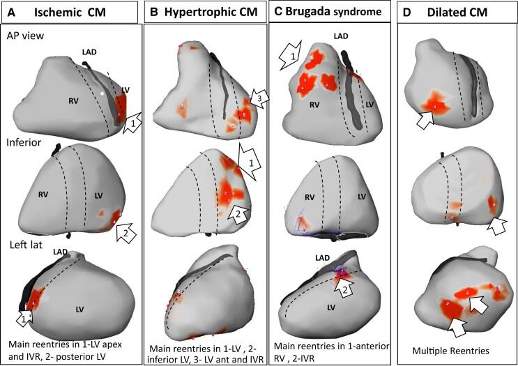 https://cdn.ncbi.nlm.nih.gov/pmc/blobs/9a4d/8934691/4e44bbde6254/ehab893f3.jpg