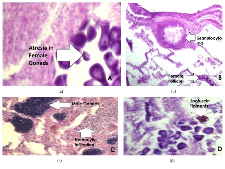 https://cdn.ncbi.nlm.nih.gov/pmc/blobs/9a51/5859875/c79cf9919b5d/BMRI2018-1910274.006.jpg