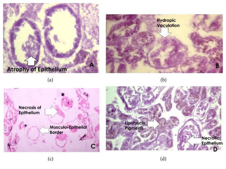 https://cdn.ncbi.nlm.nih.gov/pmc/blobs/9a51/5859875/fe199ca40b9f/BMRI2018-1910274.004.jpg