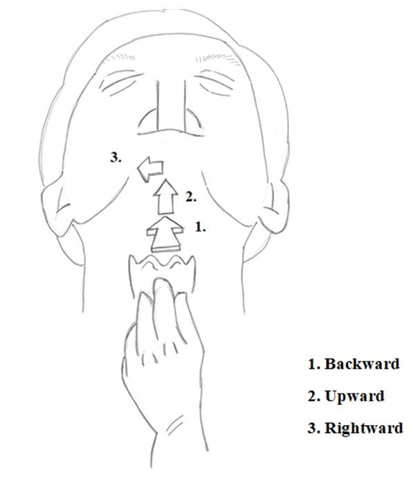 https://cdn.ncbi.nlm.nih.gov/pmc/blobs/9a55/8828619/71d00dc50889/apm-21026f1.jpg