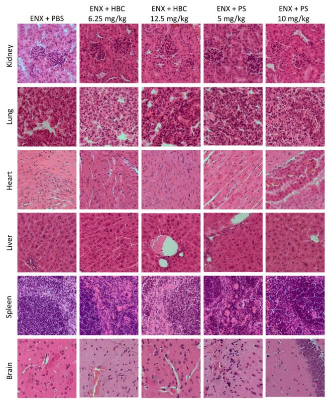 https://cdn.ncbi.nlm.nih.gov/pmc/blobs/9a59/8541278/6b6a6e3e5c9a/ijms-22-11149-g004.jpg