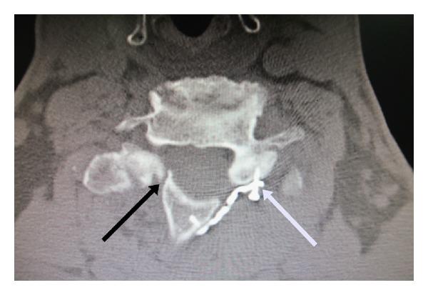 https://cdn.ncbi.nlm.nih.gov/pmc/blobs/9a5a/3858881/266afd2864a2/AOP2013-767343.006.jpg