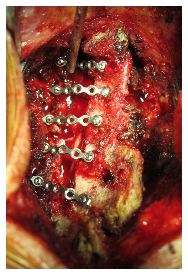 https://cdn.ncbi.nlm.nih.gov/pmc/blobs/9a5a/3858881/f47285656396/AOP2013-767343.002.jpg