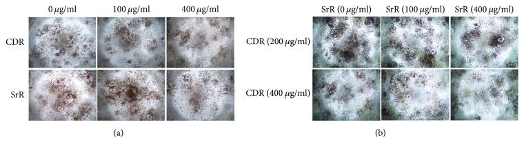 https://cdn.ncbi.nlm.nih.gov/pmc/blobs/9a5c/5804400/d13cfa66be16/ECAM2017-9795806.006.jpg