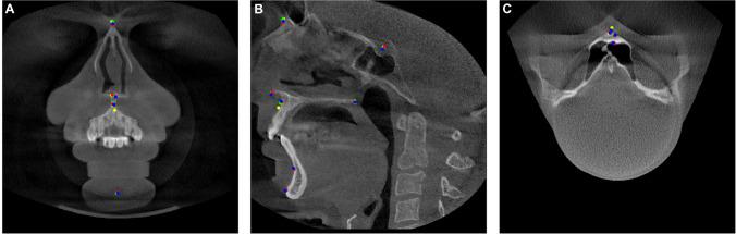 https://cdn.ncbi.nlm.nih.gov/pmc/blobs/9a5d/10159965/54763669f687/784_2023_4978_Fig1_HTML.jpg