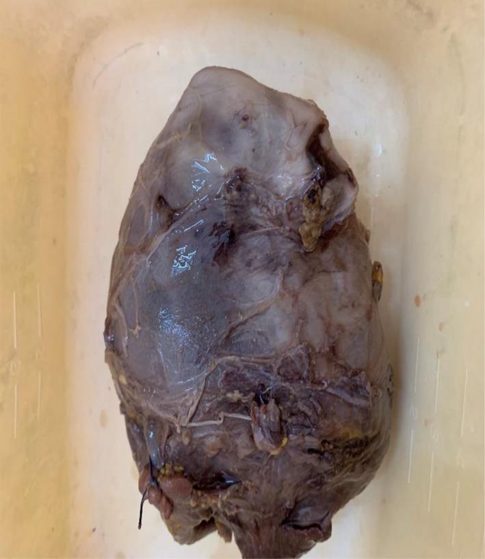 https://cdn.ncbi.nlm.nih.gov/pmc/blobs/9a65/8864576/bfb920b56d04/CCR3-10-e05493-g003.jpg