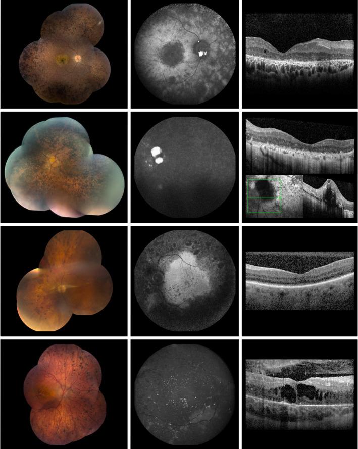 https://cdn.ncbi.nlm.nih.gov/pmc/blobs/9a66/8248330/78a262aad006/AOS-99-e402-g002.jpg