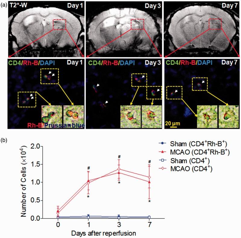 https://cdn.ncbi.nlm.nih.gov/pmc/blobs/9a67/4976749/cf315dc53895/10.1177_0271678X15611137-fig5.jpg