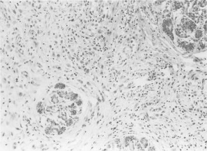 https://cdn.ncbi.nlm.nih.gov/pmc/blobs/9a6f/1374325/39fe9f893d68/gut00555-0157-a.jpg